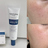 Melatoning Cream Korean Pharmacy Hyperpigmentation Treatment Cream